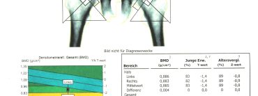 DEXA (2)